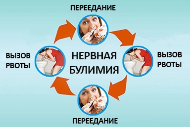 Лечение булимии в Тюкалинске